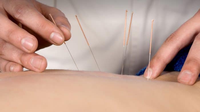 If you suffer a sports or musculoskeletal injury, a general acupuncture approach may not be sufficient. The acupuncturists at FoRM Health in Portland, Oregon offer athletes and lay people alike a...