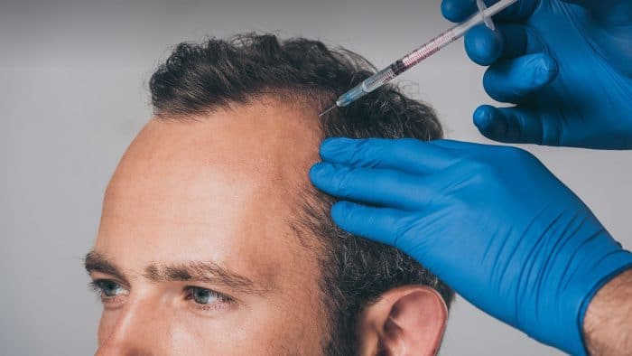 PRP + PRF Hair Restoration In Portland